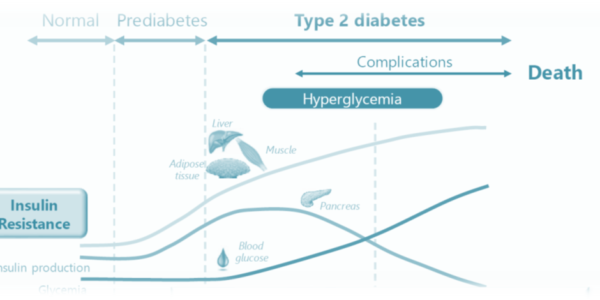 2021 05 Diabetes a silent condition